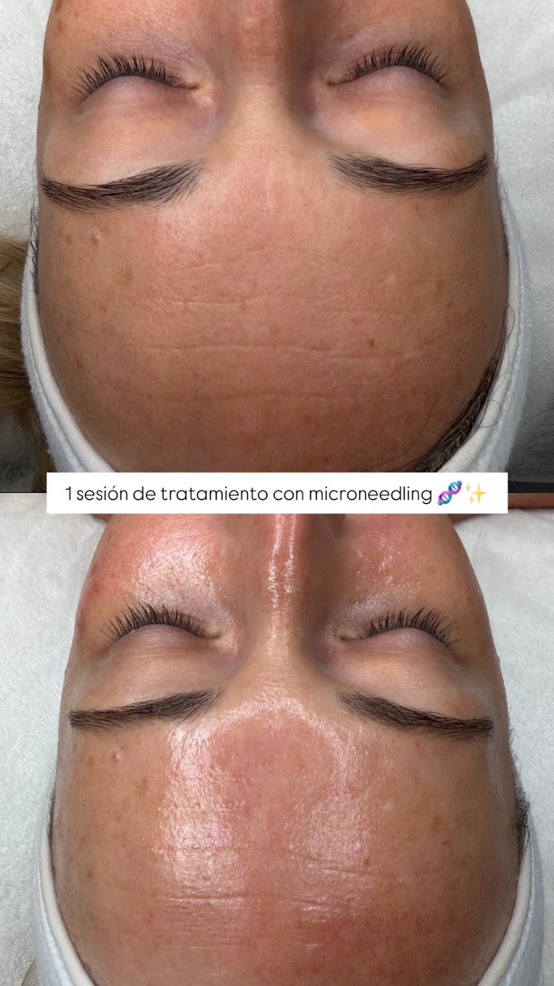 LuiBlanc Skincare & Bienestar - foto 5